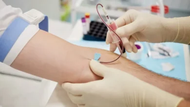 Does Urgent Care Do STD Testing